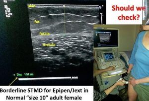 Ultasound showing muscle depth of size 10 woman