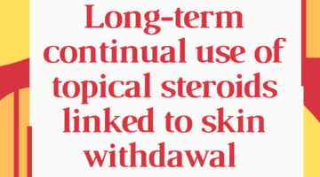 Long term continual use of topical steroids linked to skin withdrawal