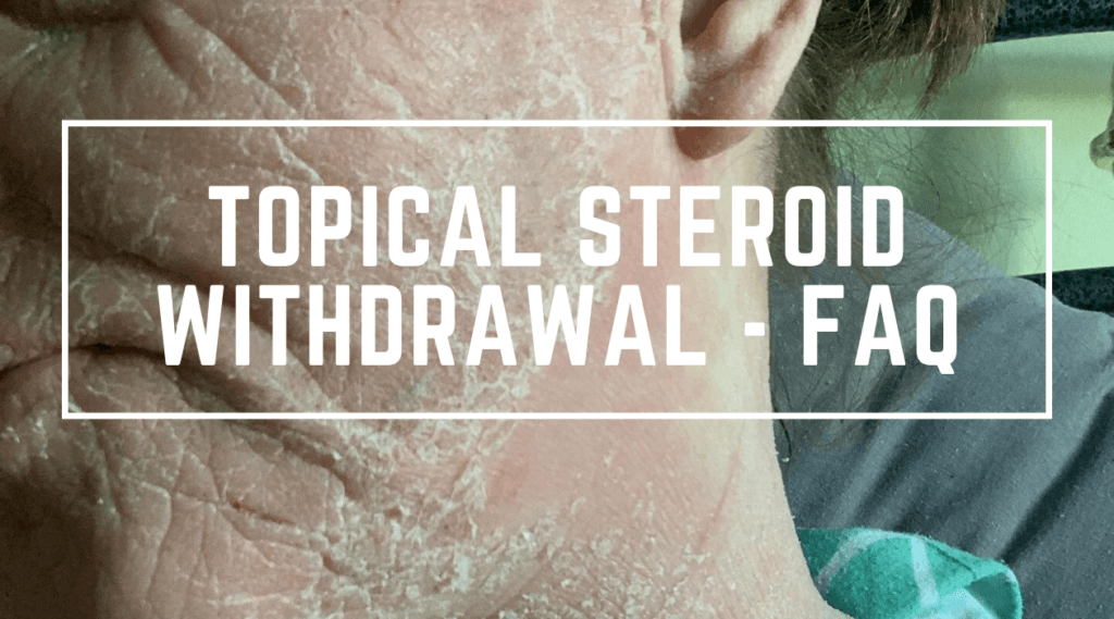 Topical Steroid Withdrawal - Frequently Asked Questions
