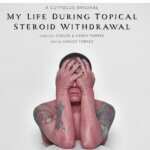 My life with topical steroid withdrawal - short film review