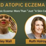 world atopic eczema day
