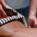 can you enjoy a massage with sensitive skin, eczema and TSW