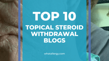 Top 10 Topical Steroid Withdrawal blogs